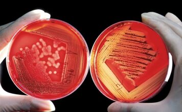 Czy można dać za dużo gruntu? Czy można dać za dużo gruntu?